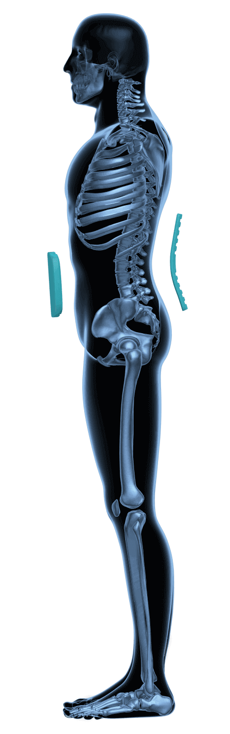 Lumbalorthese LWS zur Stabilisierung der Lendenwirbelsäule, Entlastung bei Rückenschmerzen und Bandscheibenproblemen, bessere Haltung