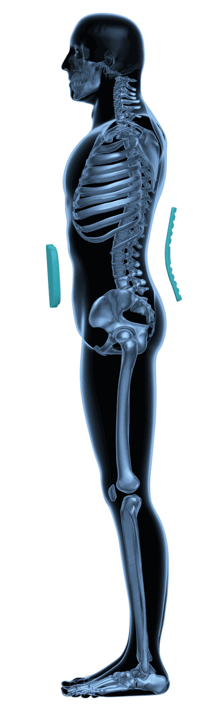 Lumbalorthese LWS zur Stabilisierung der Lendenwirbelsäule, Entlastung bei Rückenschmerzen und Bandscheibenproblemen, bessere Haltung