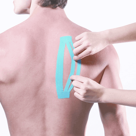 Kinesiologisches Tape Großpackung Maxtaping A+ wird am oberen Rücken angelegt – Sporttape für Praxis, Physiotherapie und Therapie