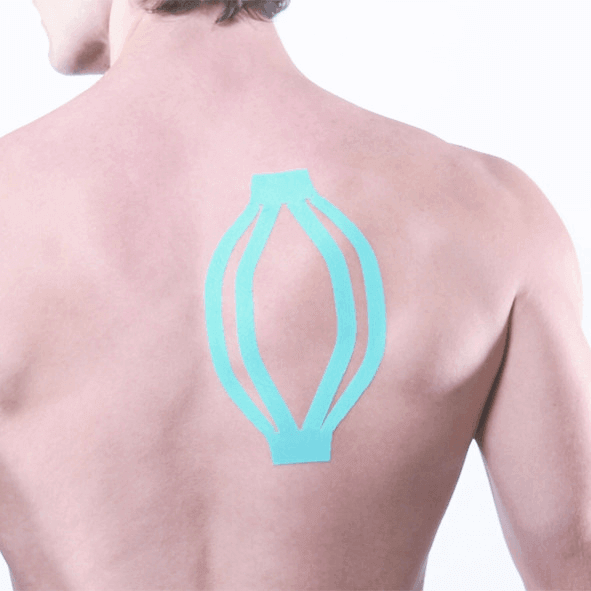 Kinesiologisches Tape Großpackung Maxtaping A+ am Rücken – Kinesio Taping zur Muskel- & Gelenkunterstützung im Sport