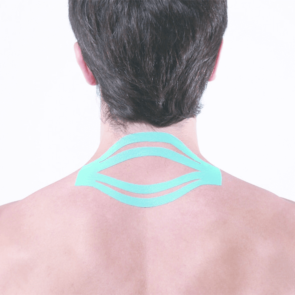 Kinesiologisches Tape Großpackung Maxtaping A+ am Nacken für Sport, Physiotherapie & Therapie – Unterstützung von Muskeln und Gelenken