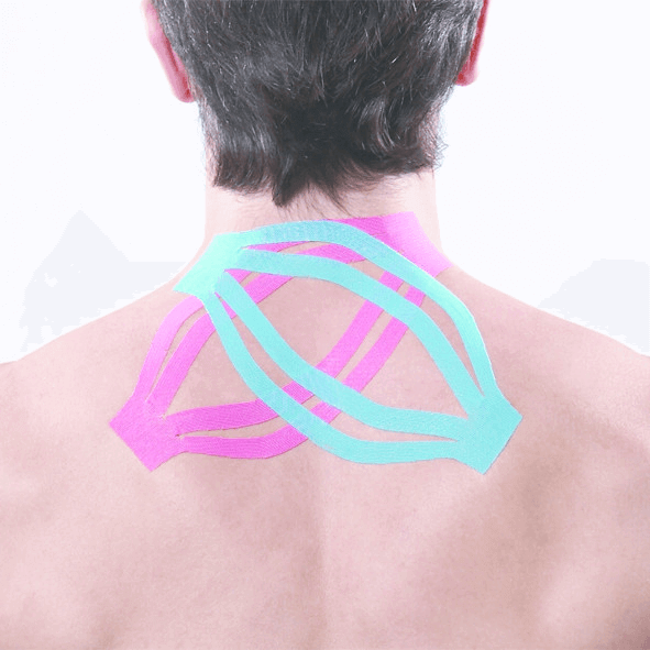 Kinesiologisches Tape Großpackung Maxtaping A+ am oberen Rücken zur Muskelunterstützung bei Sport, Physio und Therapie