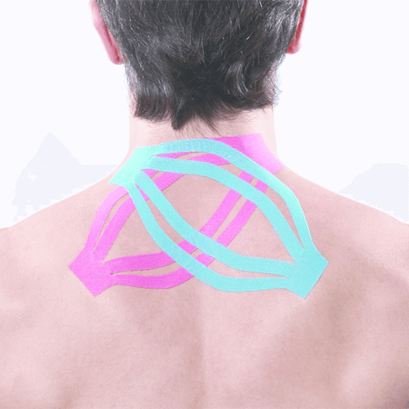 Kinesiologisches Tape Großpackung Maxtaping A+ am oberen Rücken zur Muskelunterstützung bei Sport, Physio und Therapie