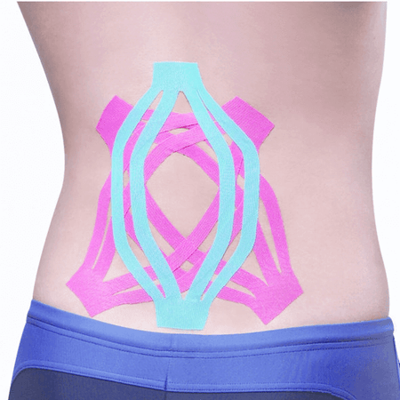 Kinesiologisches Tape Großpackung Maxtaping A+ am unteren Rücken zur Stabilisierung bei Sport, Physio und Therapie