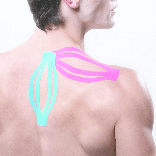 Kinesiologisches Tape Großpackung Maxtaping A+ am Schulterblatt zur Stabilisierung im Sport und in der Physiotherapie